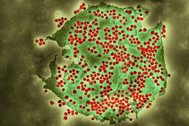 Coloured transmission electron micrograph (TEM) of a SARS-CoV-2 coronavirus particle